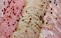 nutrition-global-15